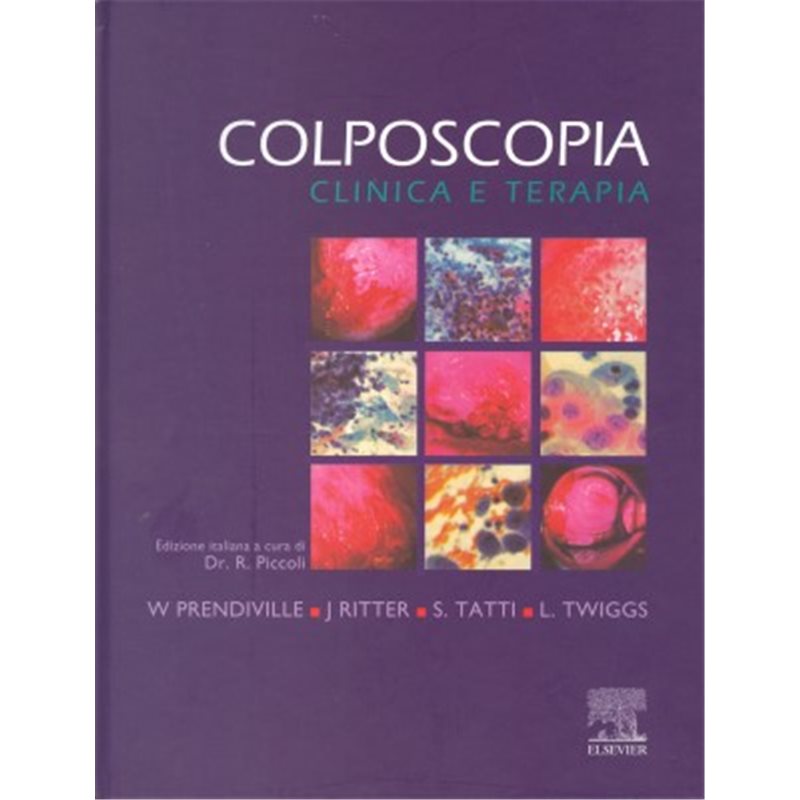 Colposcopia - Clinica e Terapia